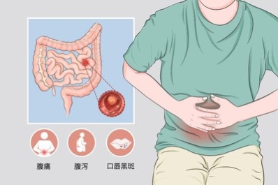 世界肠道日济南肛泰建议多点“肠”识健康“肠”伴(图3)